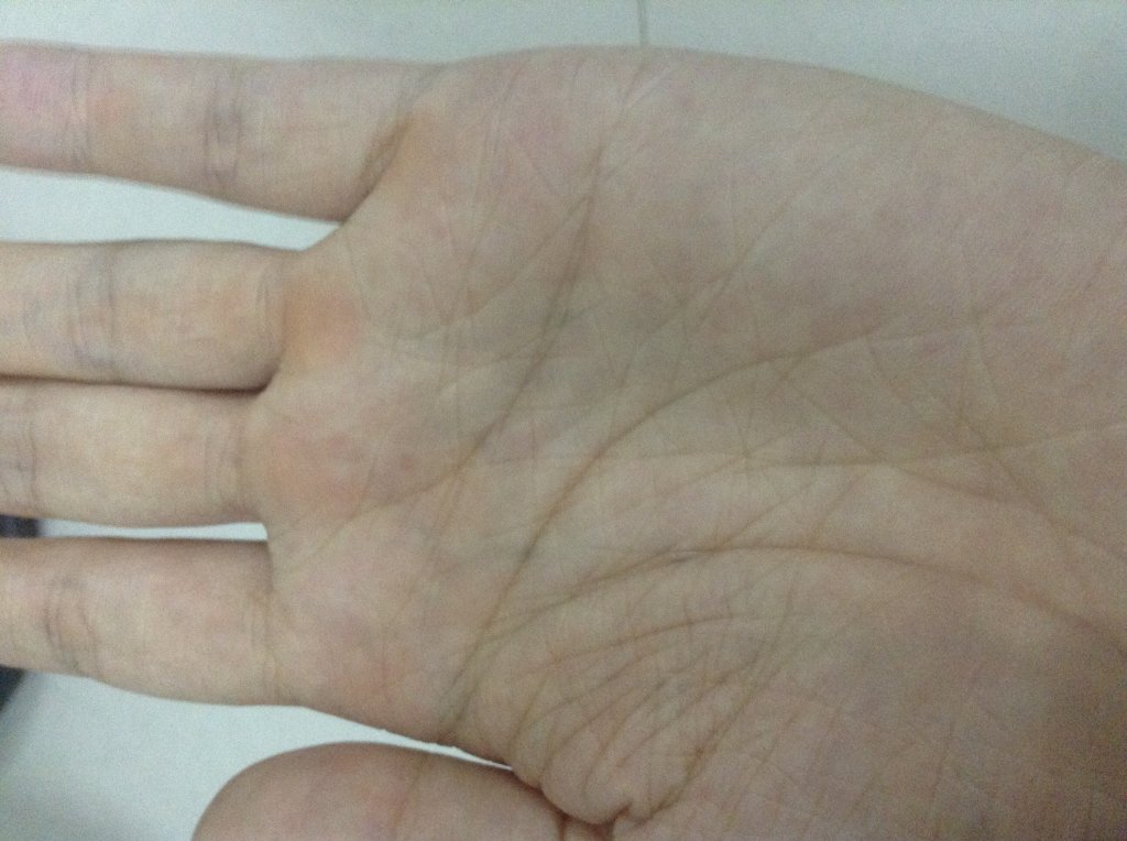 Posted Image